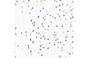 Immunohistochemistry of paraffin-embedded mouse brain using GATA2 antibody at dilution of 1:100 (x40 lens). (GATA2 anticorps)