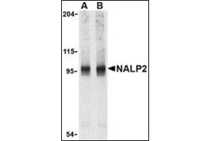 Western blot analysis of NALP2 in PC-3 cell lysate with this product at (A) 1 and (B) 2 μg/ml. (NLRP2 anticorps  (C-Term))