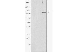 Western blot analysis of Hela whole cell lysates, using ABL1 Antibody. (ABL1 anticorps  (N-Term))