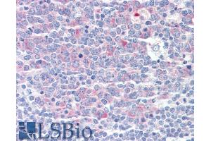 ABIN570990 (5µg/ml) staining of paraffin embedded Human Tonsil. (CCT3 anticorps  (C-Term))