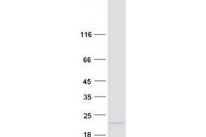 Validation with Western Blot