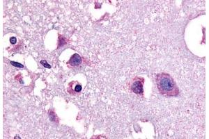 Anti-CRF1 antibody  ABIN1048460 IHC staining of human human brain, neurons and glia. (CRHR1 anticorps  (N-Term))