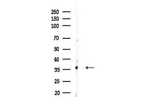 Western blot analysis of lysates from EC304 cells, using OR52E5 Antibody at 1/1000 dilution.