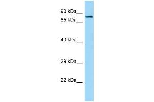WB Suggested Anti-SEMA7A Antibody Titration: 1. (SEMA7A anticorps  (C-Term))