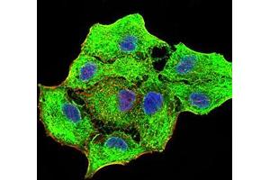 Immunofluorescence analysis of MCF-7 cells using CK5 mouse mAb (green).