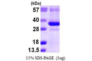 SDS-PAGE (SDS) image for CTD (Carboxy-terminal Domain, RNA Polymerase II, Polypeptide A) Small Phosphatase 1 (CTDSP1) (AA 1-260) protein (His tag) (ABIN667902) (CTDSP1 Protein (AA 1-260) (His tag))