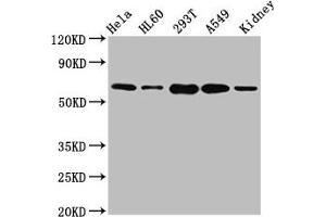 Western Blot Positive WB detected in: Hela whole cell lysate, HL60 whole cell lysate, 293T whole cell lysate, A549 whole cell lysate, Mouse kidney tissue All lanes: SLAMF6 antibody at 5. (SLAMF6 anticorps  (AA 248-331))