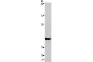 Western Blotting (WB) image for anti-Developmentally Regulated GTP Binding Protein 1 (DRG1) antibody (ABIN2429959) (DRG1 anticorps)