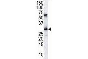 The DSCR1 antibody used in western blot to detect DSCR1 in endothelial tissue lysate