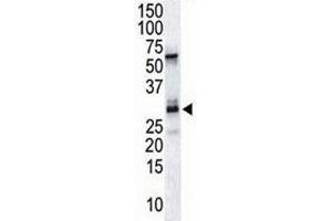 The DSCR1 antibody used in western blot to detect DSCR1 in endothelial tissue lysate (RCAN1 anticorps  (AA 222-252))