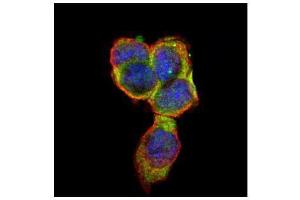 ICC/IF Image Confocal immunofluorescence analysis (Olympus FV10i) of paraformaldehyde-fixed A431, using CD66e, antibody (Green) at 1:500 dilution.