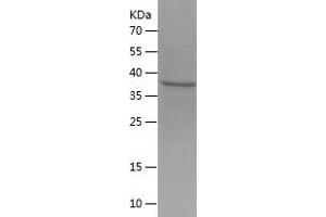 Western Blotting (WB) image for CD99 (CD99) (AA 25-122) protein (His-IF2DI Tag) (ABIN7122220)