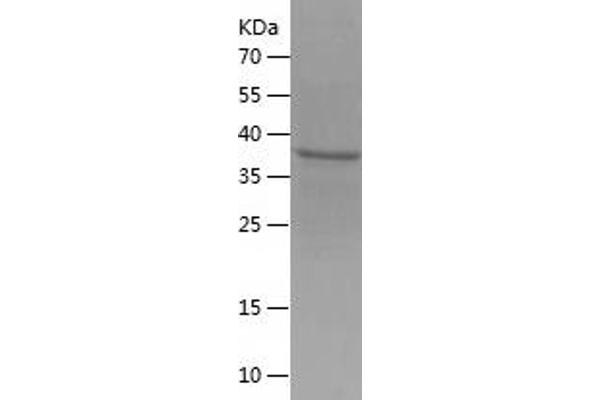 CD99 Protein (CD99) (AA 25-122) (His-IF2DI Tag)