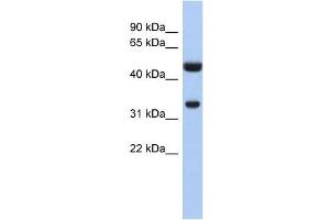 SULT1B1 antibody used at 1 ug/ml to detect target protein. (SULT1B1 anticorps  (N-Term))