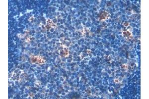 Detection of HSD17b12 in Mouse Lymph node Tissue using Polyclonal Antibody to 17-Beta-Hydroxysteroid Dehydrogenase Type 12 (HSD17b12) (HSD17B12 anticorps  (AA 1-312))