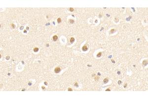 anti-NEDD8 Activating Enzyme E1 Subunit 1 (NAE1) (AA 229-534) antibody