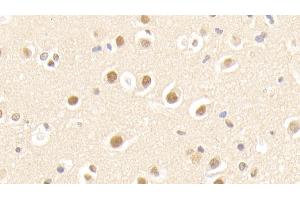 Detection of APPBP1 in Human Cerebrum Tissue using Polyclonal Antibody to Amyloid Beta Precursor Protein Binding Protein 1 (APPBP1) (Amyloid beta Precursor Protein Binding Protein 1 (AA 229-534) anticorps)