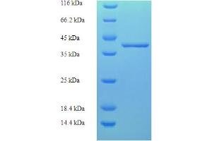 SDS-PAGE (SDS) image for Transcription Elongation Factor A (SII) N-Terminal and Central Domain Containing 2 (TCEANC2) (AA 1-208), (full length) protein (His-SUMO Tag) (ABIN5711605)