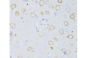 Immunohistochemistry of paraffin-embedded Rat brain using CD63 Polyclonal Antibody at dilution of 1:100 (40x lens).