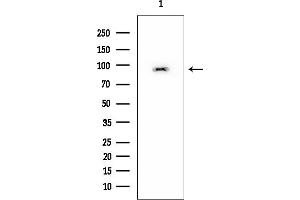 anti-Ubiquitin Specific Peptidase 13 (Isopeptidase T-3) (USP13) (C-Term) antibody
