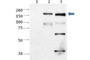 Western blot analysis of Trpm2 in CHO cells untransfected (Lane 1), CHO cell transfected with rat TRPM2 (Lane 2) and mouse cortical neurons (cultured) (Lane 3) with Trpm2 polyclonal antibody . (TRPM2 anticorps  (AA 1430-1508))