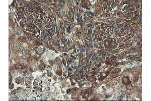 Image no. 1 for anti-Ubiquitin-Conjugating Enzyme E2, J1, U (UBE2J1) antibody (ABIN1501638)