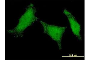 Immunofluorescence of monoclonal antibody to MED8 on HeLa cell. (MED8 anticorps  (AA 1-59))