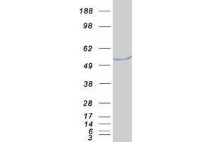 Validation with Western Blot