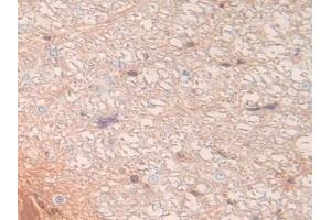 Detection of LXN in Rat Spinal Cord Tissue using Polyclonal Antibody to Latexin (LXN)