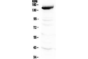 Western blot analysis of VEGF Receptor 3 using anti-VEGF Receptor 3 antibody . (FLT4 anticorps  (AA 25-259))