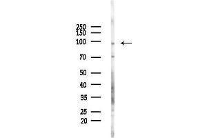 Western blot analysis of lysates from Rat brain, using TLR5 Antibody at 1/1000 dilution.