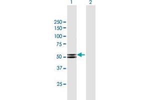 Western Blot analysis of PRKAR2B expression in transfected 293T cell line by PRKAR2B MaxPab polyclonal antibody. (PRKAR2B anticorps  (AA 1-418))