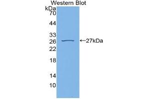Western blot analysis of recombinant Rat CYPD. (PPID anticorps  (AA 7-191))