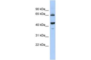 Western Blotting (WB) image for anti-Aldehyde Dehydrogenase 7 Family, Member A1 (ALDH7A1) antibody (ABIN2463934) (ALDH7A1 anticorps)