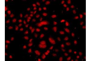 Immunofluorescence analysis of  cells using FBXW11 antibody (ABIN6133150, ABIN6140529, ABIN6140530 and ABIN6223739). (FBXW11 anticorps  (AA 1-140))