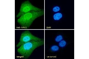 (ABIN184675) Immunofluorescence analysis of paraformaldehyde fixed U2OS cells, permeabilized with 0.