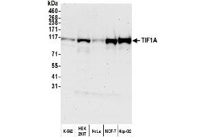 Western Blotting (WB) image for anti-Tripartite Motif Containing 24 (TRIM24) (AA 700-750) antibody (ABIN7454678) (TRIM24 anticorps  (AA 700-750))