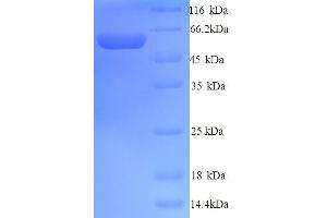 SDS-PAGE (SDS) image for Yes-Associated Protein 1 (YAP1) (AA 1-504), (full length) protein (His tag) (ABIN5713950)