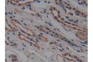 Detection of NUP155 in Human Kidney Tissue using Polyclonal Antibody to Nucleoporin 155 (NUP155)