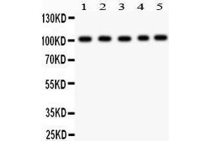 Anti- Band 3 Picoband antibody, Western blotting All lanes: Anti Band 3  at 0. (Band 3/AE1 anticorps  (AA 28-365))