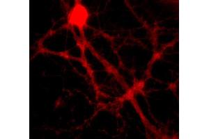 anti-SNAP alpha/beta antibody