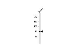 Anti-GABRQ Antibody (C-term) at 1:2000 dilution + human liver lysates Lysates/proteins at 20 μg per lane. (GABRQ anticorps  (AA 451-485))