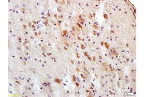 Formalin-fixed and paraffin embedded rat brain tissue labeled with Anti-Tau protein Polyclonal Antibody , Unconjugated at 1:200, followed by conjugation to the secondary antibody and DAB staining
