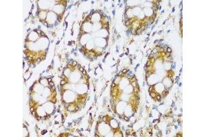 Immunohistochemistry of paraffin-embedded Human colon using ERLIN1 Polyclonal Antibody at dilution of 1:100 (40x lens). (ERLIN1 anticorps)