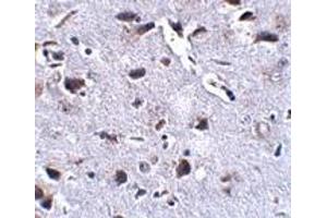Immunohistochemistry (IHC) image for anti-Regulator of Calcineurin 2 (RCAN2) (Middle Region) antibody (ABIN1031056) (RCAN2 anticorps  (Middle Region))