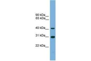 Image no. 1 for anti-Chromosome 1 Open Reading Frame 51 (C1orf51) (AA 143-192) antibody (ABIN6744999)