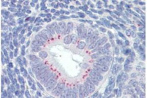 Uterus, Human: Formalin-Fixed, Paraffin-Embedded (FFPE) (SFRP1 anticorps  (AA 171-183))