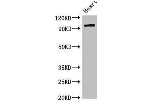 Western Blot Positive WB detected in: Rat heart tissue All lanes: PRKD3 antibody at 3 μg/mL Secondary Goat polyclonal to rabbit IgG at 1/50000 dilution Predicted band size: 101, 69 kDa Observed band size: 101 kDa (PRKD3 anticorps  (AA 326-510))