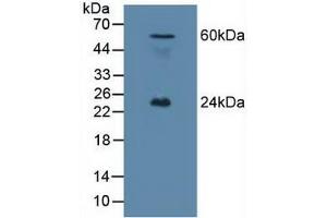 Western blot analysis of Mouse Testis Tissue. (Ephrin A1 anticorps  (AA 19-182))