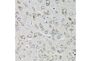 Immunohistochemistry of paraffin-embedded mouse brain using RPS10 antibody (ABIN1980247) at dilution of 1:100 (40x lens). (RPS10 anticorps)